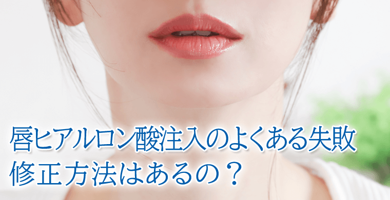 唇ヒアルロン酸注入のよくある失敗とは？修正方法はあるの？