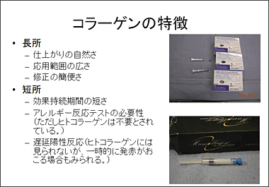 コラーゲン注入 特別セミナー