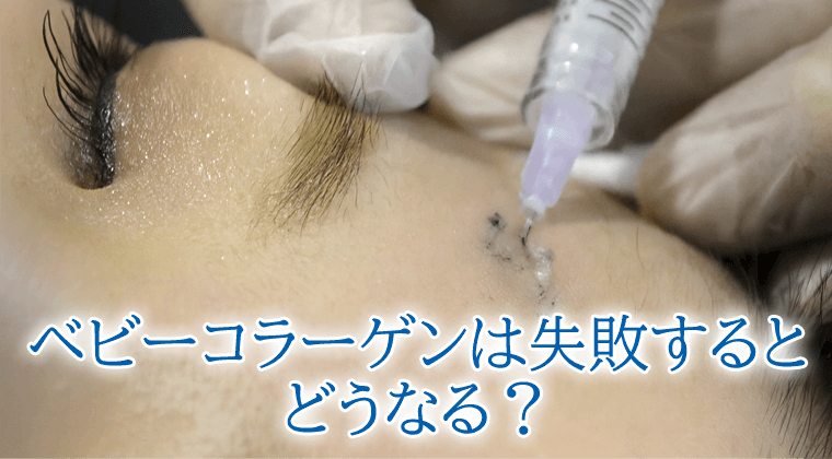 ベビーコラーゲンは失敗するとどうなる?リスクと対処法を徹底解説