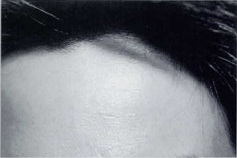 治療前