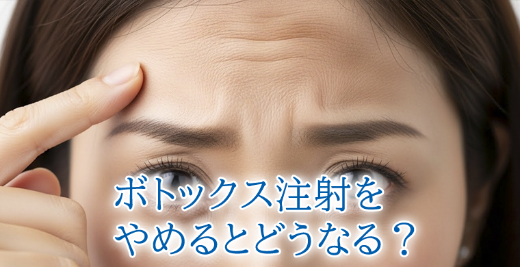 ボトックス注射をやめるとどうなる？安心して受けるためのポイント